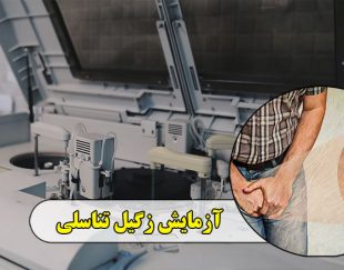 آزمایش زگیل تناسلی